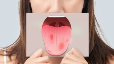 أعراض فقر الدم النفسية